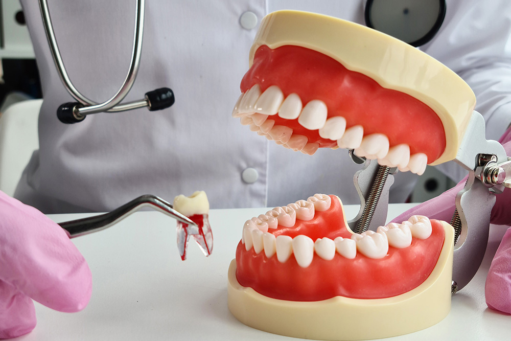 Tooth Extraction: What to Expect and How to Care for Your Smile