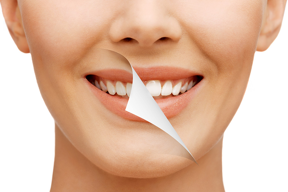 Teeth Whitening: Brighten Your Smile with Complete Health Dentistry of Woodland Hills