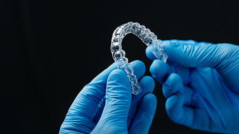 Clear Aligners: The Adult Choice for Orthodontics