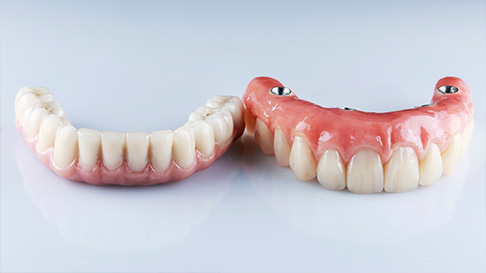 Permanent Dentures: Your Smile’s Best Long-Term Investment